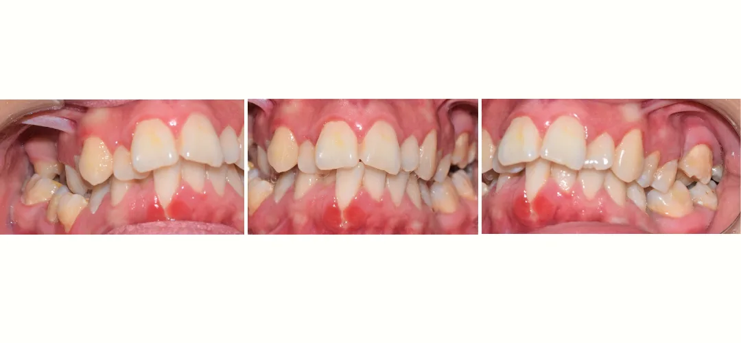 CAZ 31 BEFORE