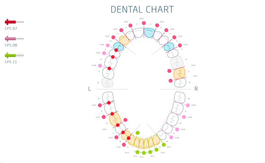 preventie dentara