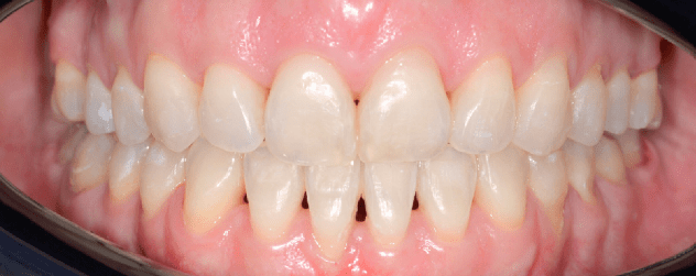 Captură de ecran 2026-01-09 041334