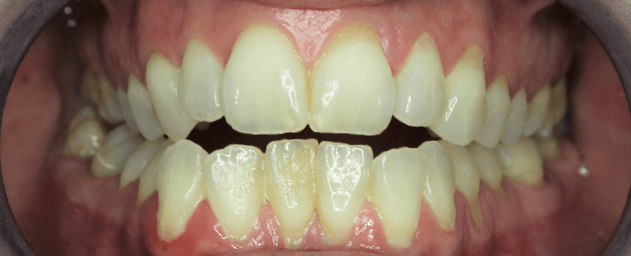 Captură de ecran 2026-01-09 041356