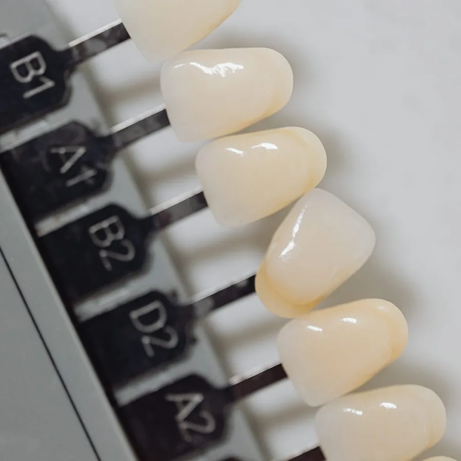 Mostre pentru alegerea nuanței unei restaurări dentare
